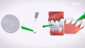 Leczenie nadwrażliwości szyjek zębowych – co stosować w terapii domowej?